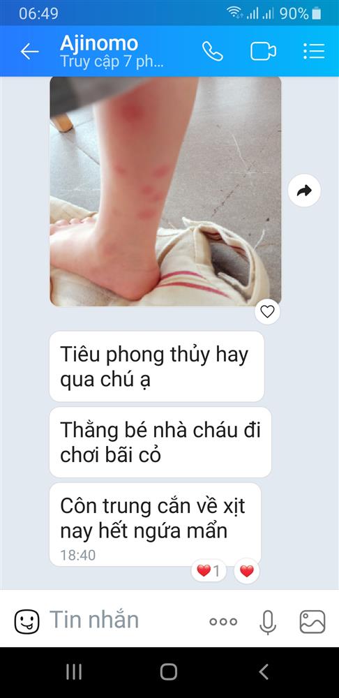 tiêu phong thủy trị côn trùng đốt